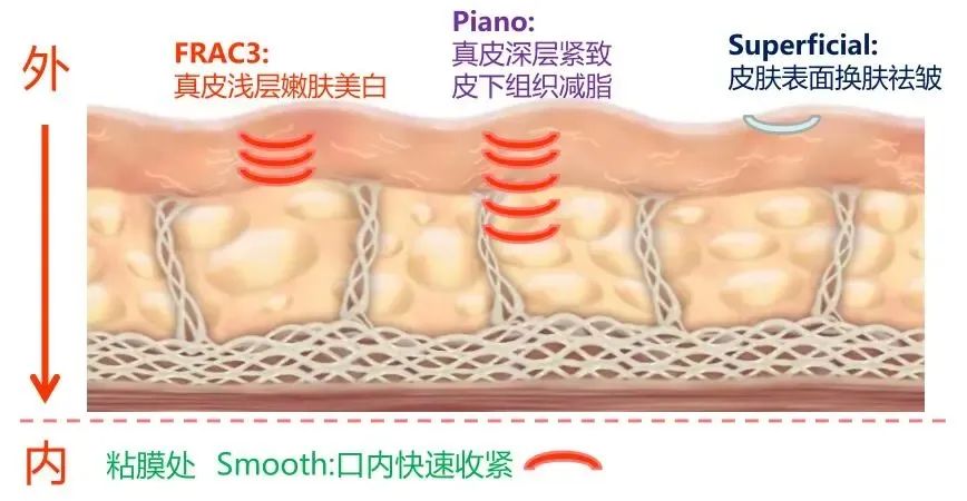 Fotona4D點(diǎn)陣激光.12.jpg