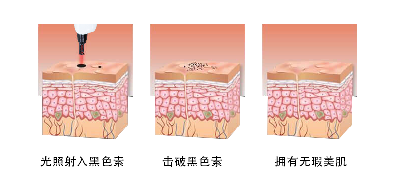 臺式無(wú)創(chuàng  )洗眉機.2.png