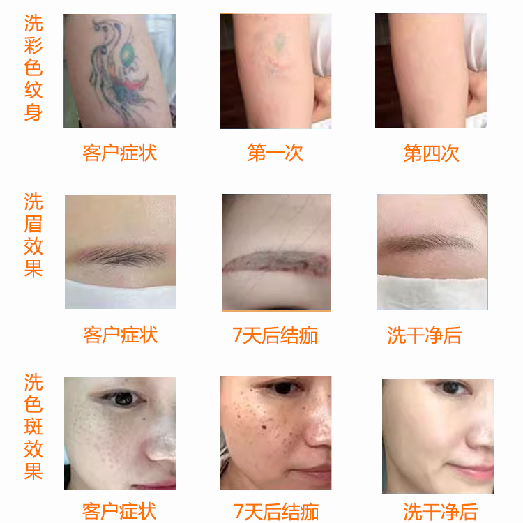 外貿款臺式小皮秒.jpg