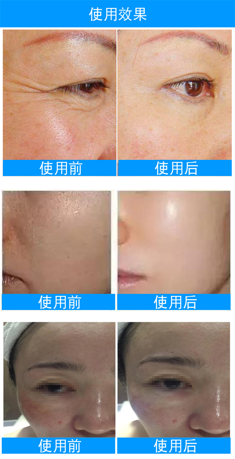 Seyo無(wú)針水光.8.jpg